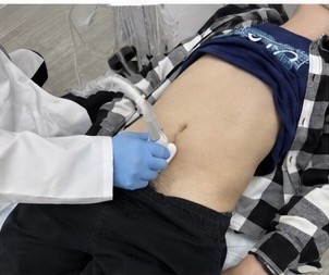 Abdominal ultrasound exam for urinary and prostate symptoms