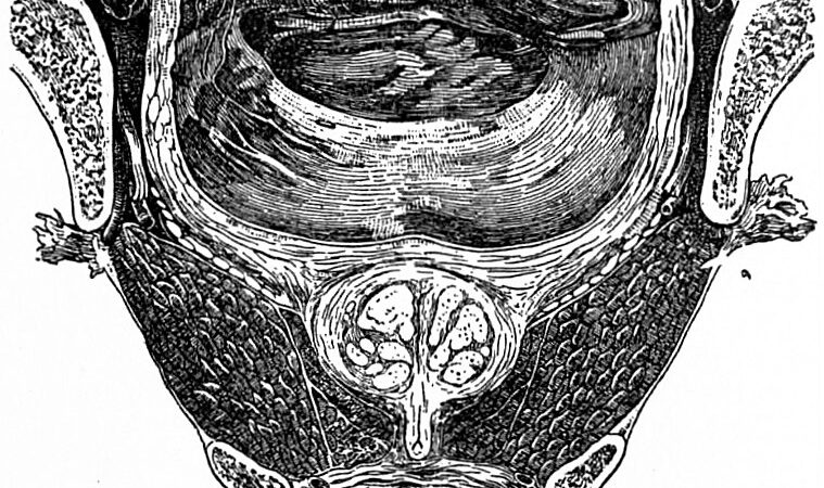 Erectile Dysfunction and Prostate Health: What May Link Them?